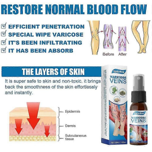 Varicose Vein Massage Spray 1pc 1