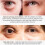 Creme para os olhos com nicotinamida remove olheiras e bolsas sob os olhos 6