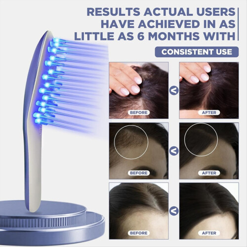 Laser Therapy Hair Growth Comb Model,Hand-Held Comb-Shaped 2