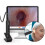 1280p HD Digital Otoscope with Adjustable Light & Computer File Transfer 1