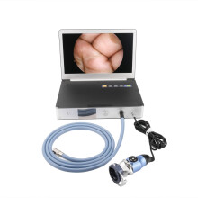 Advanced Full HD Endoscope Camera with 30W LED Cold Light Source & 11.6-Inch Monitor