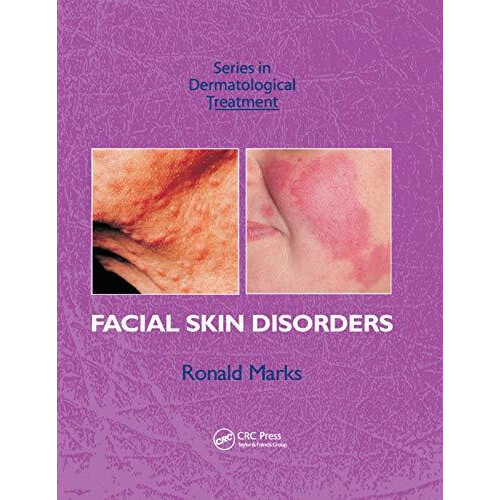 Facial Skin Disorders by Ronald Marks Paperback Book