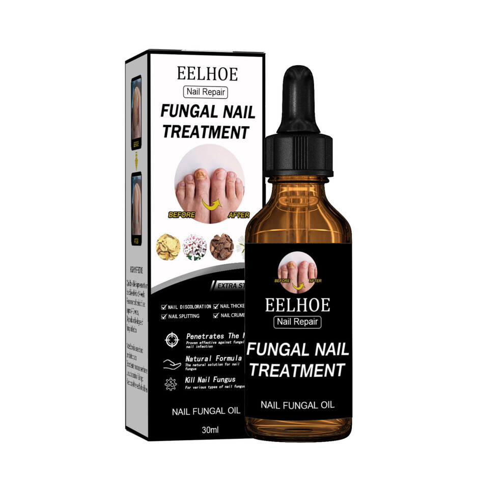 30ml Toenail & Fingernail Repair Drops Nail Care Renewal for Thick, Damaged & Discolored Nails