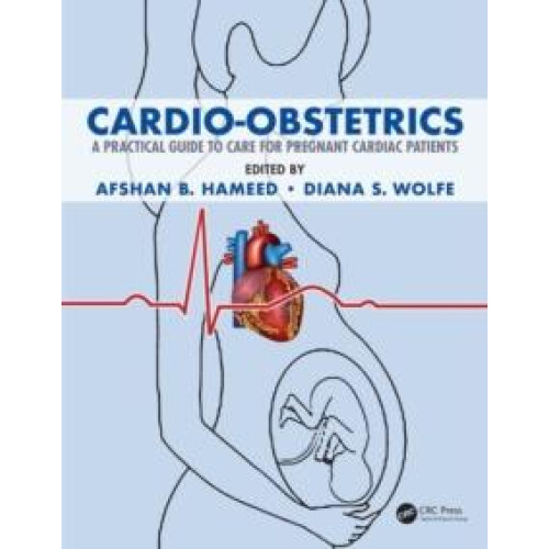 CardioObstetrics Paperback Book