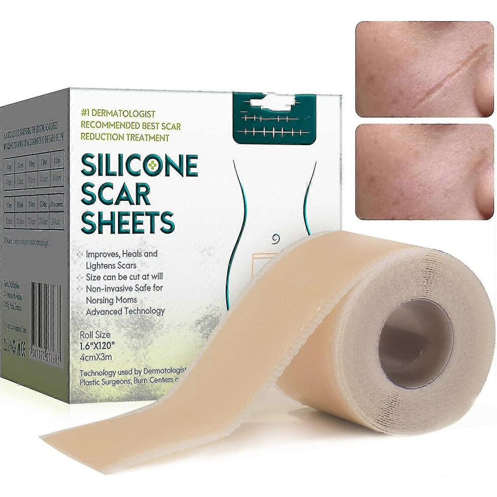 Silicone Plasters For Scars, Silicone Scar Films For Surgeries, Caesarean Section, Keloids, Burns,silicone Scar Tape-4cm*3m