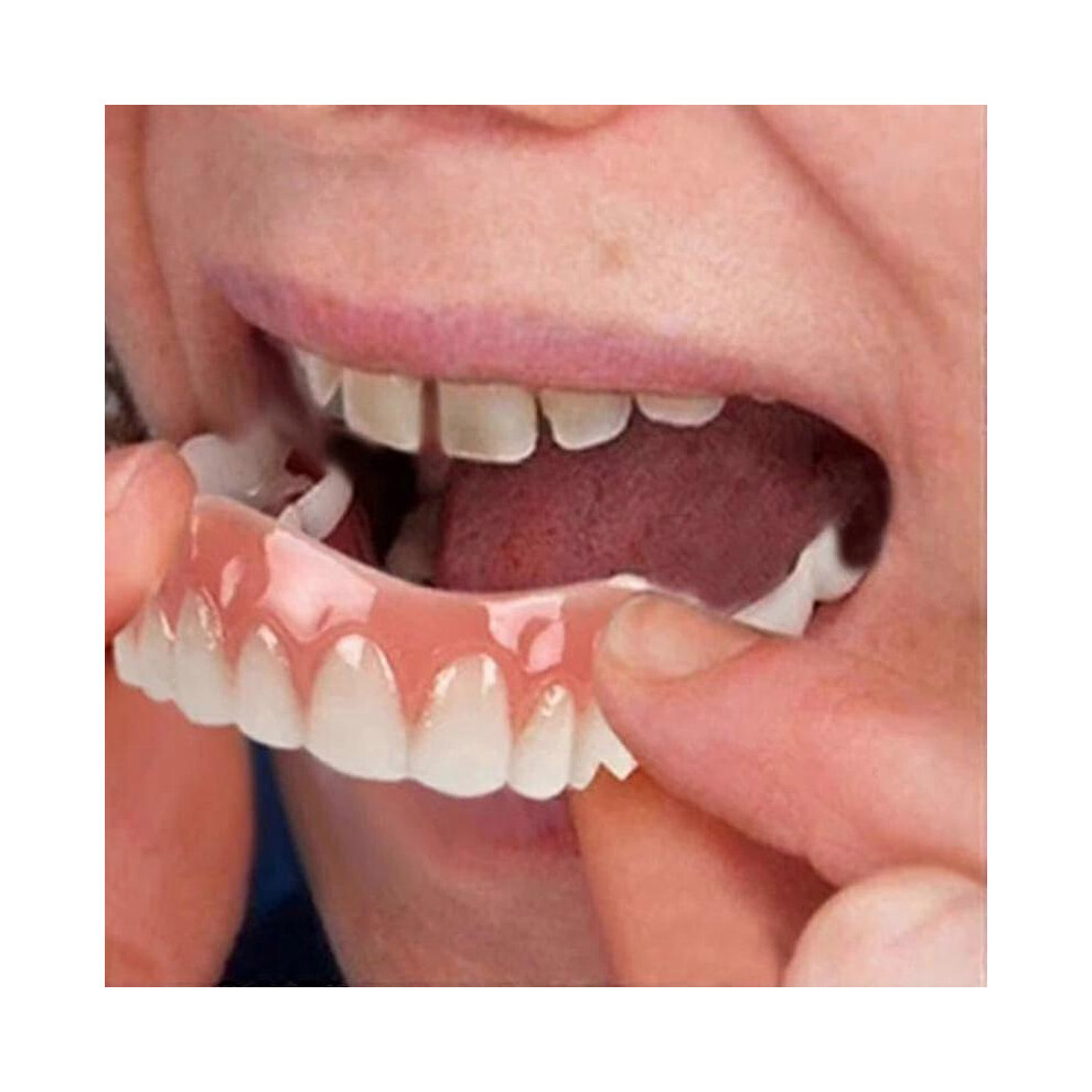 Kikidex (As Show, One Size) Extra Thin Fake Bright Tooth Veneers Silicone Soft Safe Adhesive Denture Hide Shade Braces Comfortable Teeth Orthodontic White
