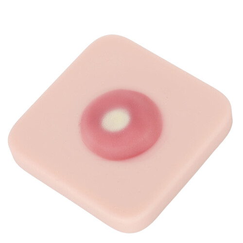 Abszess-Inzisionsdrainagepad zur Zystenentfernung 2