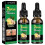 2PCS 7-Day Ginger Nail Conditioner 1