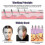 (0.25mm)Men's Beard Growth Derma Roller - Micro Needle Hair Regrowth 4