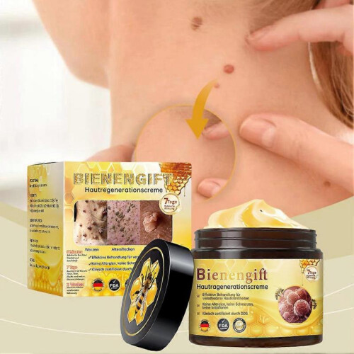 (2pcs)Bee-Venom Cream Fast Effective Wart Removing Cream for Body Face Use 2