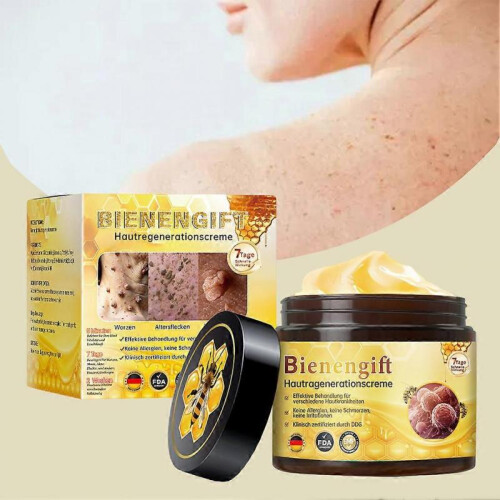(3pcs)Bee-Venom Cream Fast Effective Wart Removing Cream for Body Face Use 2