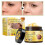 (2pcs)Bee-Venom Cream Fast Effective Wart Removing Cream for Body Face Use 4