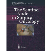 The Sentinel Node in Surgical Oncology by Peter J. Ell Paperback Book