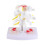 Anatomical Lumbar Disc Herniation Spine Training Model 3