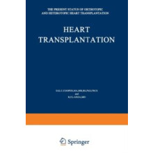 Heart Transplantation Paperback Book