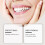 (As show, One size) Advanced Customized Full Denture Set, Silicone Reline Denture Set 5