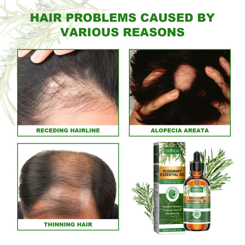 EELHOE Rosmarin-Ätherisches Öl 60ml für Haarwachstum 2