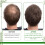 EELHOE Rosmarin-Ätherisches Öl 60ml für Haarwachstum 5