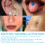 South Moon Ear Hole Care Spray 30ml 5