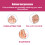 Tiptoe Correction Silicone Split Toe Protector Soft Elastic Washable 1