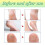 XIMONTH 10pcs Foot Bath Tablets Exfoliating 5