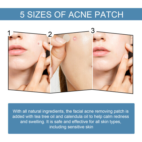 EELHOE Acne Patch Invisible Anti-Acne Waterproof Hydrocolloid 2