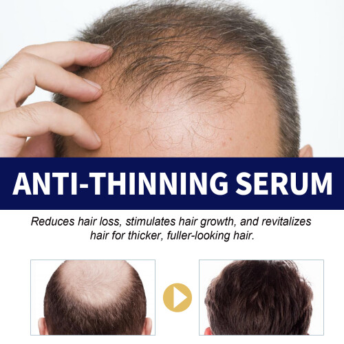 EELHOE Siero Antiriduzione Capelli 2