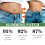EELHOE 10 Patches Body Slimming Navel Fat Burning 3
