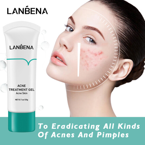 LANBENA Acne Gel 20g Spot Treatment 1