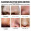 West & Month Blackhead Stickers 10PCS 1