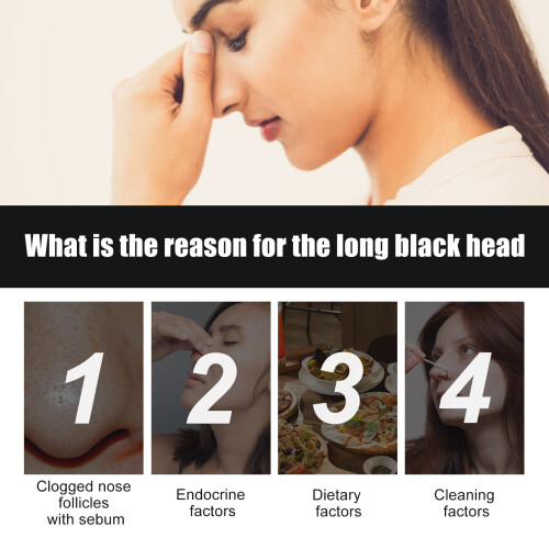 West & Month Blackhead Stickers 10PCS 1