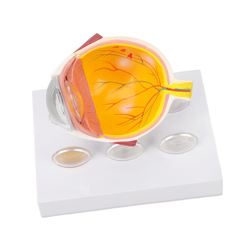 Anatomisches Augenmodell mit Sehnerv und Linse 2