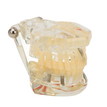 Transparent Dental Implant Model for Teaching