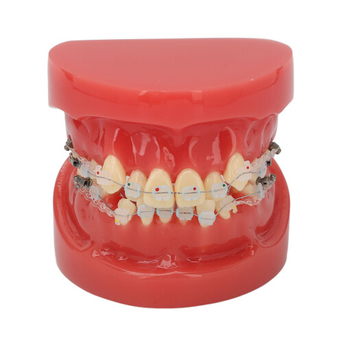 Ceramic Orthodontic Demo Model 24 Teeth with Brackets and Wires