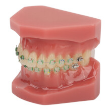 Dental Orthodontic Model Teeth with Metal Wires Bracket Teaching