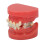 Ceramic Orthodontic Demo Model 24 Teeth with Brackets and Wires 3
