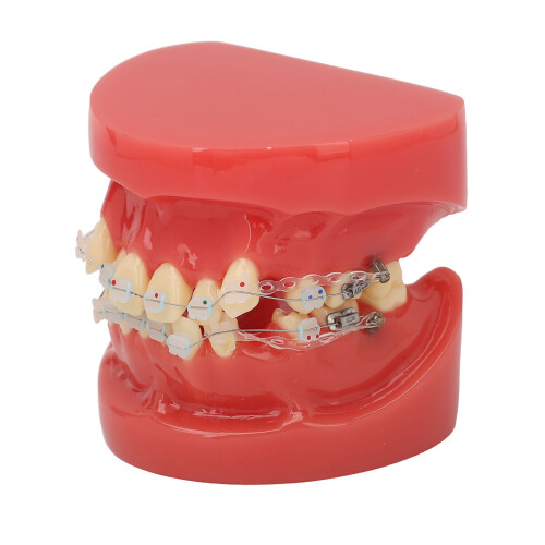 Ceramic Orthodontic Demo Model 24 Teeth with Brackets and Wires 2