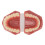28-Tooth Orthodontic Teaching Study Model 5
