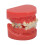 Ceramic Orthodontic Demo Model 24 Teeth with Brackets and Wires 2