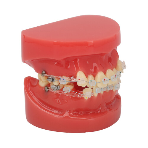 Ceramic Orthodontic Demo Model 24 Teeth with Brackets and Wires 1
