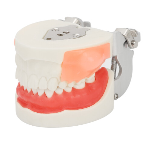 Bilateral Cystic Tooth Model for Teaching 1