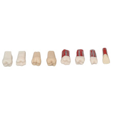 8x Wurzelkanal-Zähne Modell Harz Endodontie