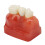 Modelo dentale impianto 4x corona ponte 3