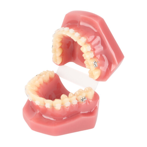 Ceramic Orthodontic Model Teeth Metal Wires Bracket Teaching 2