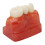 Modelo dentale impianto 4x corona ponte 2