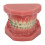 Dental Orthodontic Model Teeth with Metal Wires Bracket Teaching 2