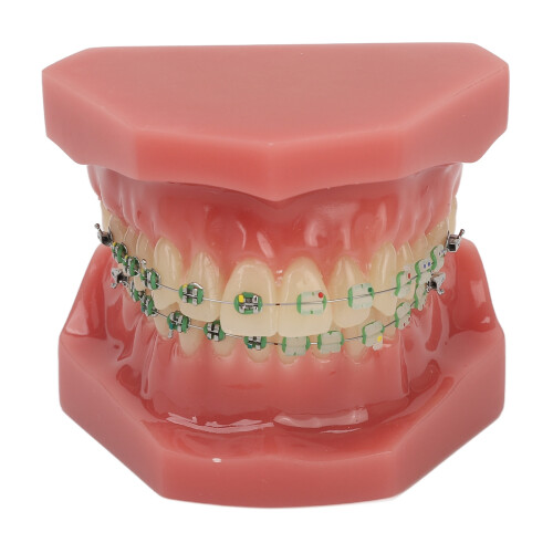Dental Orthodontic Model Teeth with Metal Wires Bracket Teaching 1