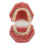 Dental Orthodontic Model Teeth with Metal Wires Bracket Teaching 5