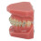 Dental Orthodontic Model Teeth with Metal Wires Bracket Teaching 4