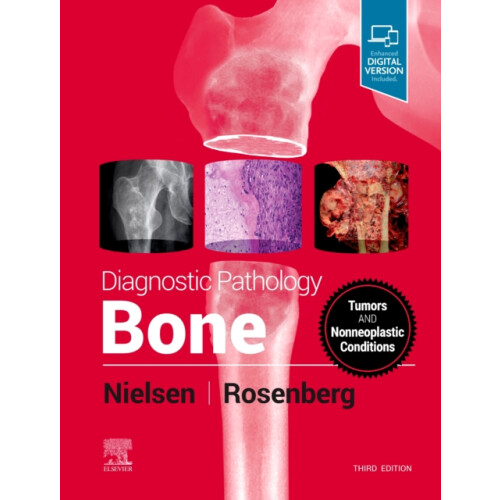 Diagnostic Pathology Bone by Rosenberg Andrew E. Professor and Vice Ch